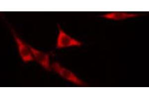 ABIN6268773 staining hacat cells by IF/ICC. (KRT14 Antikörper  (N-Term))