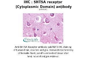 Image no. 1 for anti-Serotonin Receptor 5A (HTR5A) (3rd Cytoplasmic Domain) antibody (ABIN1731379) (Serotonin Receptor 5A Antikörper  (3rd Cytoplasmic Domain))
