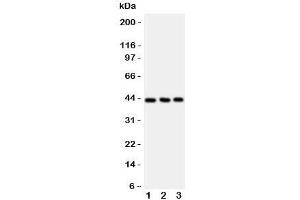 Western blot testing of CCR9 antibody and Lane 1:  Jurkat;  2: HeLa;  3: SMMC-7721 cell lysate.