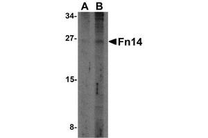 Western blot analysis of Fn14 in HepG2 cells with AP30344PU-N Fn14 antibody at (A) 2 and (B) 4 μg/ml. (TNFRSF12A Antikörper)