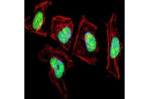 Fluorescent confocal image of Hela cell stained with NFIC Antibody . (NFIC Antikörper  (AA 180-208))