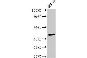 Western Blot Positive WB detected in: MCF-7 whole cell lysate All lanes: SFRP4 antibody at 3 μg/mL Secondary Goat polyclonal to rabbit IgG at 1/50000 dilution Predicted band size: 40 kDa Observed band size: 40 kDa (SFRP4 Antikörper  (AA 293-346))