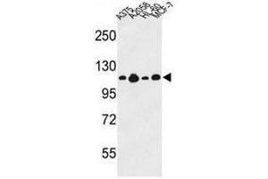 Western blot analysis of COL17A1 Antibody (Center) in A375, A2058, HL-60, MCF-7 cell line lysates (35µg/lane). (COL17A1 Antikörper  (Chain alpha 1, Middle Region))