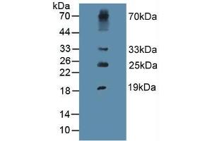 Figure. (PIIINP Antikörper  (AA 24-153))