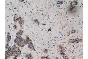 IHC-P analysis of Human Breast Tissue, with DAB staining. (Ataxin 1 Antikörper  (AA 569-807))