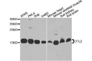 Western blot analysis of extracts of various cell lines, using CFL2 antibody. (Cofilin 2 Antikörper  (AA 1-166))