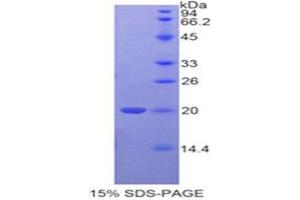 SDS-PAGE (SDS) image for Tafazzin (TAZ) (AA 154-292) protein (His tag) (ABIN1879494) (TAZ Protein (AA 154-292) (His tag))