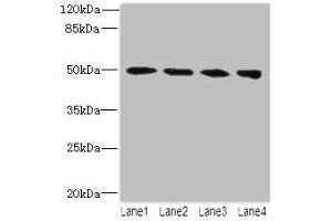 Western blot All lanes: TUBB2A antibody at 14 μg/mL Lane 1: MCF-7 whole cell lysate Lane 2: Hela whole cell lysate Lane 3: HepG2 whole cell lysate Lane 4: MDA-MB-231 whole cell lysate Secondary Goat polyclonal to rabbit IgG at 1/10000 dilution Predicted band size: 50 kDa Observed band size: 50 kDa (TUBB2A Antikörper  (AA 1-445))