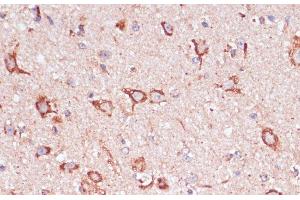 Immunohistochemistry of paraffin-embedded Mouse spinal cord using ENTPD6 Polyclonal Antibody at dilution of 1:100 (40x lens). (ENTPD6 Antikörper)