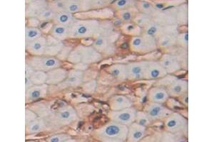 IHC-P analysis of Human Tissue, with DAB staining. (SLC1A5 Antikörper  (AA 327-541))