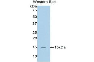 Western Blotting (WB) image for anti-Single Immunoglobulin and Toll-Interleukin 1 Receptor (TIR) Domain (SIGIRR) (AA 1-118) antibody (ABIN1171738) (SIGIRR Antikörper  (AA 1-118))