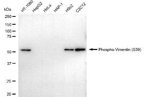 Western blotting analysis using Phospho-Vimentin (S39) antibody (ABIN7800837).