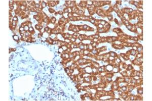 Formalin-fixed, paraffin-embedded human liver in colon stained with Heat Shock Protein 60 Mouse Monoclonal Antibody (HSPD1/875). (HSPD1 Antikörper)