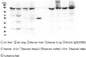 Western blot analysis of CRM1 using anti-CRM1 antibody .