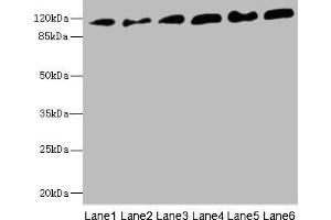 Western blot All lanes: PCDH1 antibody at 2. (Protocadherin 1 Antikörper  (AA 60-220))