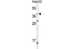 ZNF763 Antibody (C-term) western blot analysis in HepG2 cell line lysates (35 µg/lane). (ZNF763 Antikörper  (C-Term))