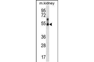 Western blot analysis in mouse kidney tissue lysates (35ug/lane). (STK32B Antikörper  (C-Term))