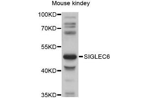 Western blot analysis of extracts of mouse kidney, using SIGLEC6 antibody (ABIN6292272) at 1:1000 dilution. (SIGLEC6 Antikörper)