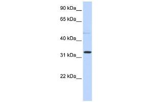 NEU4 antibody used at 1 ug/ml to detect target protein.