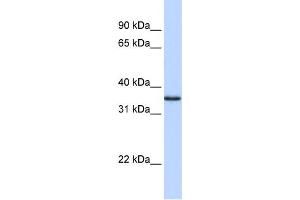 WB Suggested Anti-COPS5 Antibody Titration:  0. (COPS5 Antikörper  (N-Term))