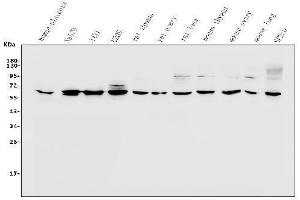 Western blot analysis of PAX1 using anti-PAX1 antibody (ABIN7600659).