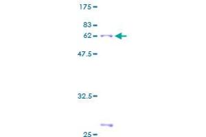 Image no. 1 for Annexin A3 (ANXA3) (AA 1-323) protein (GST tag) (ABIN1345188) (Annexin A3 Protein (ANXA3) (AA 1-323) (GST tag))