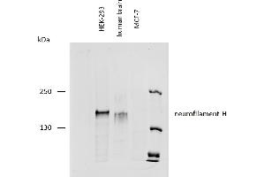 Western blotting analysis of human neurofilament H protein using mouse monoclonal antibody NF-01 on lysates of HEK-293 cell line, human brain lysate, and MCF-7 cell line (neurofilament non-expressing cell line, negative control) under reducing conditions.