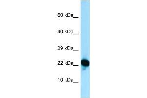 Host: Rabbit Target Name: RPL18A Sample Type: Jurkat Whole Cell lysates Antibody Dilution: 1. (RPL18A Antikörper  (C-Term))