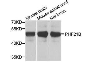Western blot analysis of extracts of various cell lines, using PHF21B antibody. (PHF21B Antikörper  (AA 322-531))