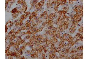 IHC image of ABIN7127355 diluted at 1:100 and staining in paraffin-embedded human liver tissue performed on a Leica BondTM system. (Rekombinanter ATP5B Antikörper)