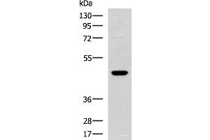Western blot analysis of TM4 cell lysate using DNAJA4 Polyclonal Antibody at dilution of 1:800 (DNAJA4 Antikörper)