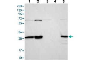 Western blot analysis of Lane 1: RT-4, Lane 2: U-251 MG, Lane 3: Human Plasma, Lane 4: Liver, Lane 5: Tonsil with INO80E polyclonal antibody  at 1:250-1:500 dilution.