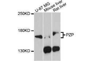 Western blot analysis of extracts of various cell lines, using PZP antibody (ABIN5971715) at 1:3000 dilution. (PZP Antikörper)