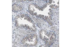 Immunohistochemical staining of human prostate with ZNF516 polyclonal antibody  shows granular cytoplasmic positivity in glandular cells. (ZNF516 Antikörper)