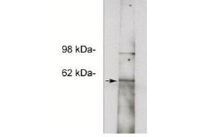 Image no. 1 for anti-Notum Pectinacetylesterase Homolog (NOTUM) antibody (ABIN265168) (NOTUM Antikörper)