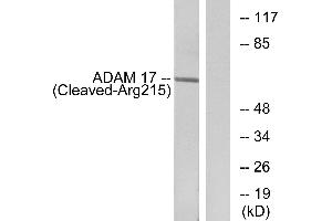 Western blot analysis of extracts from rat liver cells, using ADAM 17 (Cleaved-Arg215) antibody. (ADAM17 Antikörper  (Cleaved-Arg215))