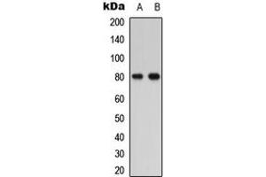Western blot analysis of PTHR1 expression in HEK293T (A), COLO205 (B) whole cell lysates. (PTH1R Antikörper  (Center))