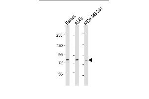 All lanes : Anti-TLR2 Antibody at 1:500-1:1000 dilution Lane 1: Ramos whole cell lysate Lane 2: A549 whole cell lysate Lane 3: MDA-MB-231 whole cell lysate Lysates/proteins at 20 μg per lane. (TLR2 Antikörper)