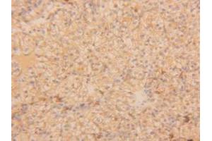 Figure. (TPSAB1 Antikörper  (AA 161-262))