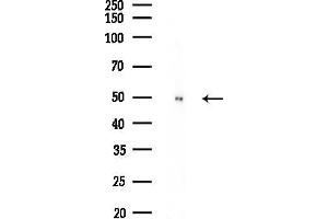 Western blot analysis of lysates from HepG2 cells(heat-shock,45 min treatment), using PPM1L Antibody at 1/1000 dilution.