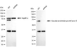 Western blotting analysis using Vascular endothelial growth factor D antibody (ABIN7797810).