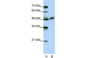 WB Suggested Anti-WDR13 Antibody Titration:  1. (WDR13 Antikörper  (N-Term))