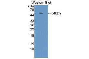 Western blot analysis of the recombinant protein. (ADCY9 Antikörper  (AA 852-1065))