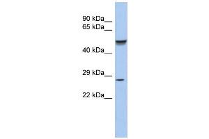 WB Suggested Anti-PHOX2A Antibody Titration:  0.