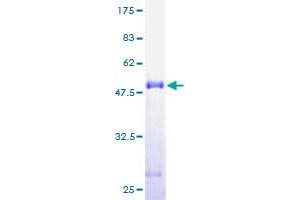 ACOT9 Protein (AA 1-212) (GST tag)