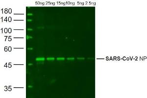 Recombinant SARS-CoV-2 N Protein probed with ABIN6952440 at 1:1000 (SARS-CoV-2 Nucleocapsid Antikörper  (AA 1-419))