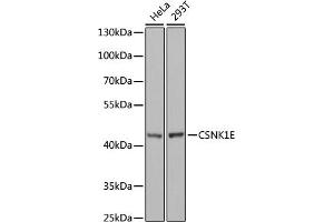 Western blot analysis of extracts of various cell lines, using CSNK1E antibody (ABIN6128970, ABIN6139116, ABIN6139117 and ABIN7101448) at 1:1000 dilution. (CK1 epsilon Antikörper  (AA 247-416))