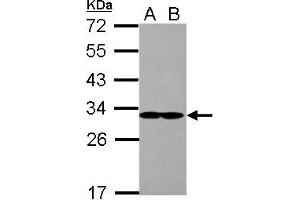 Image no. 2 for anti-Eukaryotic Translation Initiation Factor 2B, Subunit 1 Alpha, 26kDa (EIF2B1) (AA 1-305) antibody (ABIN1497966) (EIF2B1 Antikörper  (AA 1-305))