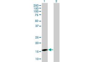 Western Blot analysis of BST2 expression in transfected 293T cell line by BST2 MaxPab polyclonal antibody. (BST2 Antikörper  (AA 40-180))