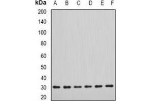 Western blot analysis of DDAH2 expression in SW620 (A), MCF7 (B), mouse lung (C), mouse kidney (D), rat heart (E), rat brain (F) whole cell lysates. (DDAH2 Antikörper)